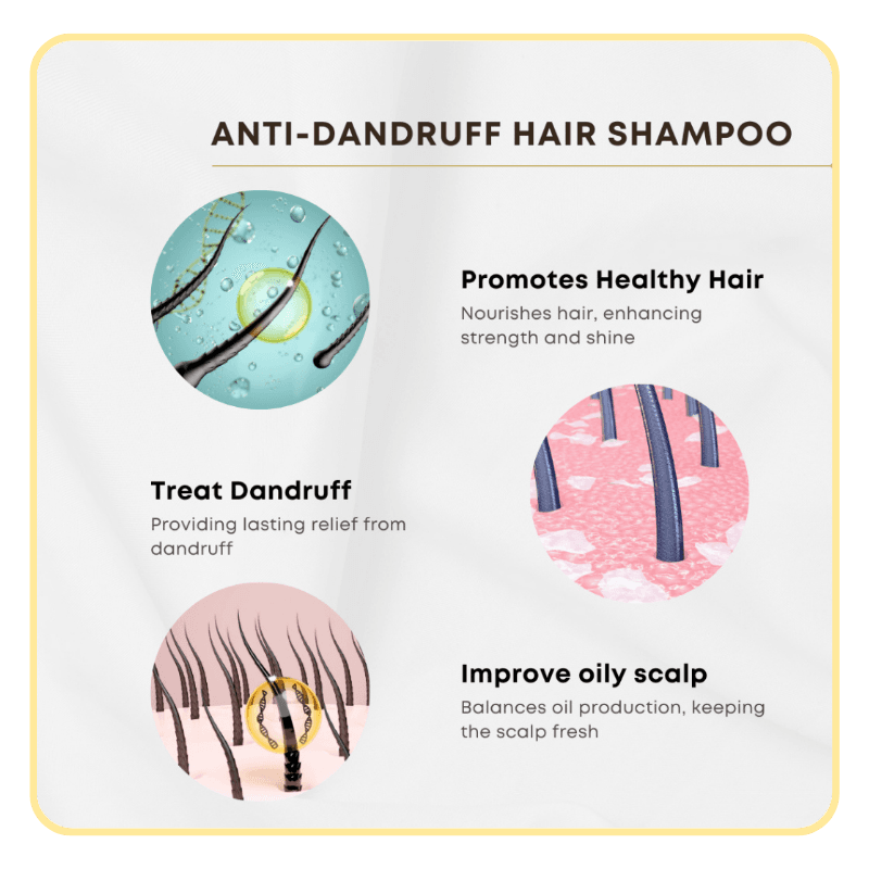 HUMIDE Anti-Dandruff Hair Shampoo | For Oily, Itchy & Combination Scalp (500 ml) - Image 5